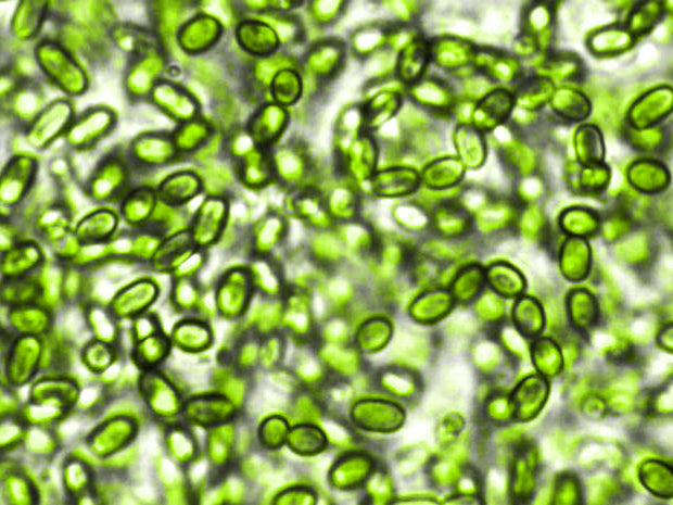 Probiotic (Enterococcus faecium)